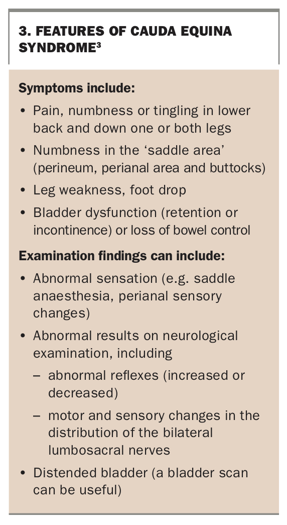 Beware the cauda equina not just another low back pain Medicine Today
